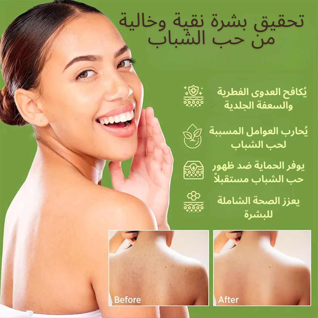 Veloura® AntiFungal Relief Soap Bar
